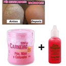 Kit Anti Rachadura nos Pés: 2 Gota Milagrosa + Sebo de Carneiro - Adeus Rachaduras Hidratante