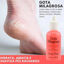 Kit Anti Rachadura nos Pés: 2 Gota Milagrosa + Sebo de Carneiro - Adeus Rachaduras Hidratante